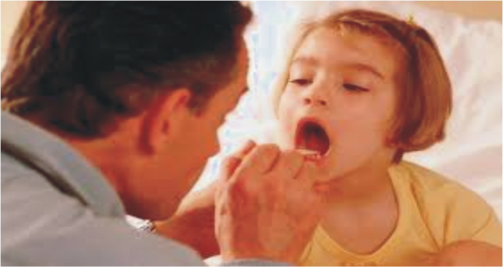 Mengatasi Halitosis Bau Mulut Tidak Sedap